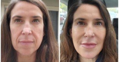 The Future of Anti-Aging at Eternia Medspa