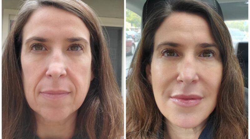 The Future of Anti-Aging at Eternia Medspa